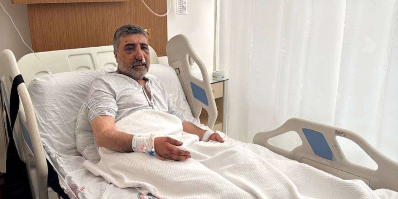 ingiliz boksorun darp ettigi taksicinin davasi goruldu geceleri bagirarak uyaniyorum QLSqhg6j.jpg